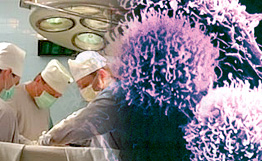 علماء روس يصممون جهازا لمعرفة حدود الورم السرطاني