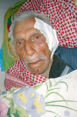 خاص الانتقاد.نت: حدث في طمون..مسن فلسطيني مقعد نهشته كلاب الاحتلال والجنود يتضاحكون بدم بارد..
