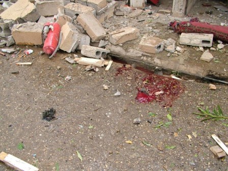 سوريا: تسعة ضحايا في انفجار سيارة مفخخة في دير الزور (صور) 