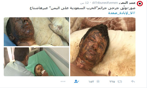 تغريدات وتعليقات متضامنة مع محافظة صعدة في وجه عدوان مملكة &rsquo;قرن الشيطان&rsquo;