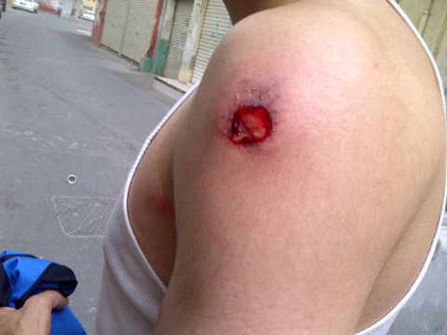 حوار الملك تحت نيران مرتزقة النظام