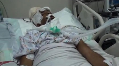 البحرين: استشهاد مواطن متأثراً بإصابته برصاص الشوزن

