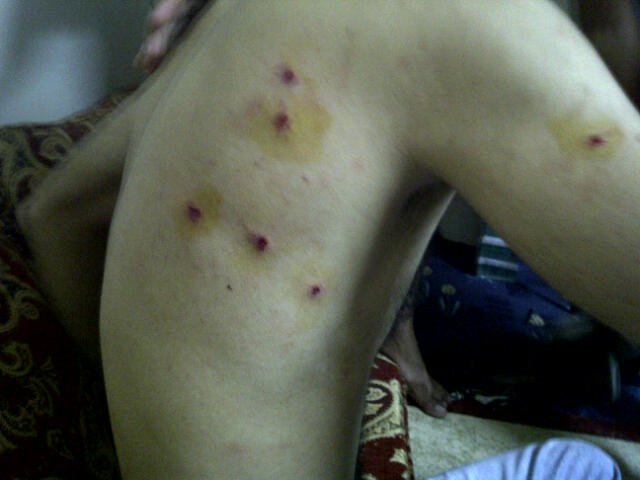 رفع حالة "السلامة الوطنية" (الطوارئ).. ضحك على الذقون
