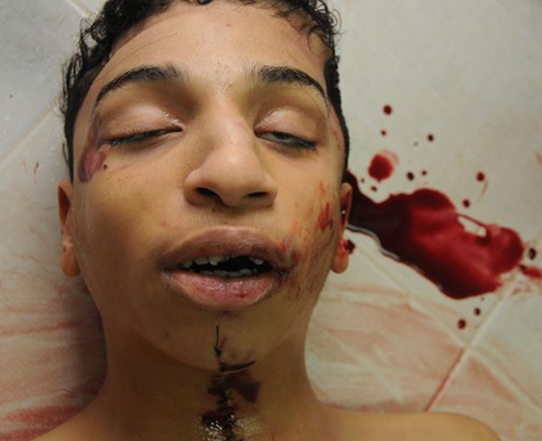 البحرين: استشهاد فتى وقوات الأمن تقمع مسيرة التشييع