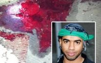 البحرين: "الوفاق" تدعو قوات الأمن إلى كشف مصير شاب تعرض لإصابة بالغة

