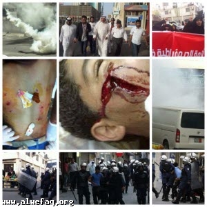 قوات الامن البحرينية تمعن في قمعها المسيرات السلمية مستخدمة أنواعا مختلفة من الاسلحة وقنابل الغاز وسلاح الشوزن المحرم دوليا