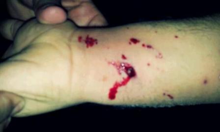 البحرين: الأمن يقمع بالقوة مسيرة سلمية ويستهدف الشيخ علي سلمان وعدد من قياديي الجمعيات السياسية المعارضة

