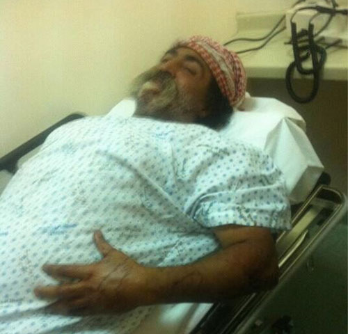 الأمن البحريني يستهدف طفل ويصيبه بشكل بليغ برصاص الشوزن
