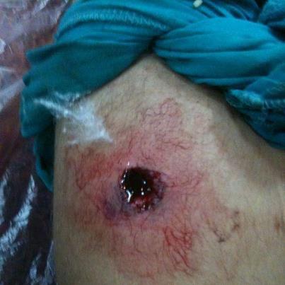 إصابات بالغة وإعتقالات واسعة أثناء قمع القوات السعودية لمظاهرة سلمية في القطيف