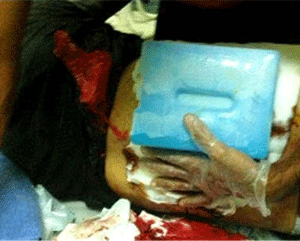 الامن البحريني يصيب مواطنا في بلدة كرانة بالرصاص الحي