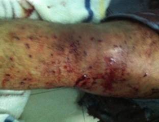 قوات الأمن البحرينة تفرض "حظر التظاهر" بقوة وجمعية "الوفاق" ترفض "مصادرة الحريات"