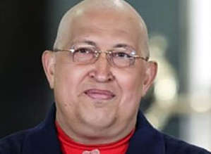 الحكومة الفنزويلية تؤكد أن صحة تشافيز في "تحسن"