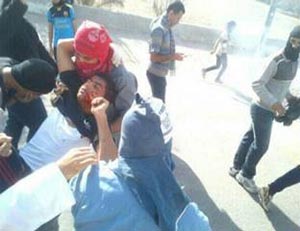 إصابة خطيرة لشاب في أبو صيبع.. وإضراب عام في البحرين اليوم