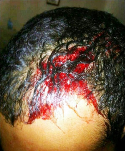 ضرب وحشي لمواطن في المرخ ضرب وحشي لمواطن في المرخ (مصور)