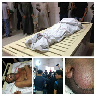 عائلة الجزيري تتسلم جسد ابنها المحتجز لدى السلطات البحرينية 