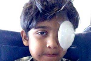 طفل بحريني يخسر عينه بسبب وحشية قوات الامن البحرينية