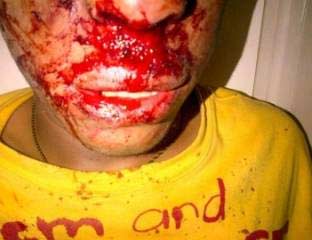 قوات النظام تعتدي بوحشية على طفل في منطقة صدد
