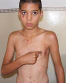 الاحتلال الصهيوني وانتهاك حقوق الاطفال الفلسطينيين