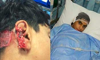 إصابة فتى برصاص الأمن السعودي في العوامية