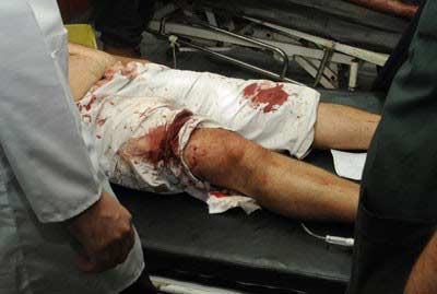 مجزرة في ريف تلكخ بحمص