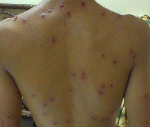 البحرين: مواجهات بين قوات الأمن ومتظاهرين 