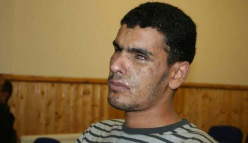  النظام البحريني يعذب معتقلين معاقين ويحرمهم من الرعاية الطبية