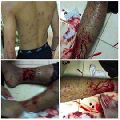 &rsquo;الوفاق&rsquo;: ليلة قاسية بتمزيق أجساد المواطنين بالأسلحة النارية 