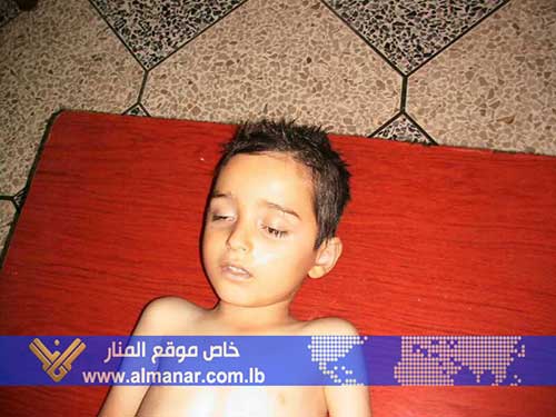 صور من آثار قصف الارهابيين لبلدة نبل بريف حلب  