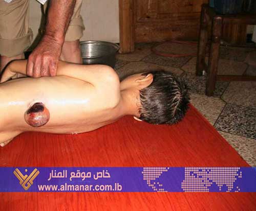 صور من آثار قصف الارهابيين لبلدة نبل بريف حلب  