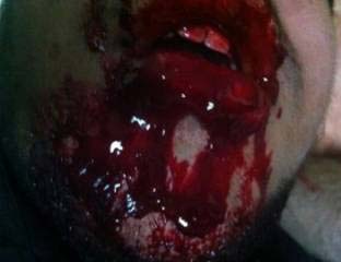 &rsquo;البحرينية لحقوق الإنسان&rsquo;: معظم قرى البحرين تعرضت أمس لعقاب جماعي أوقع إصابات خطيرة 