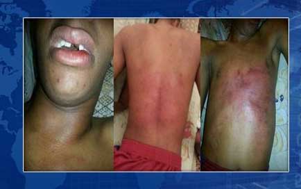 ضابط يعذب مواطناً بحرينياً بشكل وحشي 