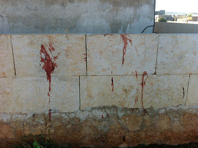 حلب.. نزيف متواصل في نبّل والزهراء  