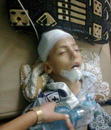 ارتكاب مجزرة بحق اطفال احدى مدارس بلدة الزهراء