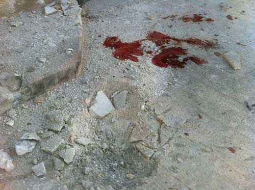 ارتكاب مجزرة بحق اطفال احدى مدارس بلدة الزهراء