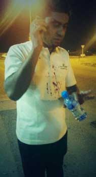 البحرين: إصابة آسيوي برصاص الشوزن في الدراز