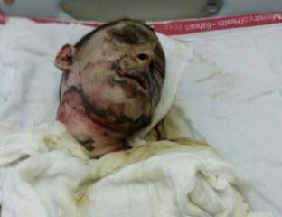 إستشهاد فتى بحريني متأثراً بجراحه