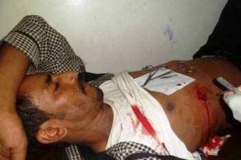 استمرار التوتر جنوبي اليمن بعد أيام من انطلاق &rsquo;الهبة الشعبية&rsquo;