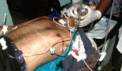 الجيش اليمني يقصف مدينة الضالع بالمدفعية الثقيلة