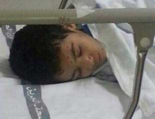 البحرين: قوات الأمن تصيب طفلاً في سترة