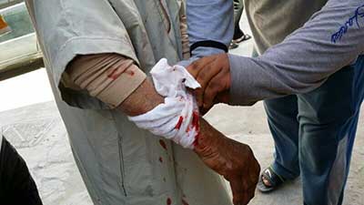 استشهاد إمرأة بحرينية
