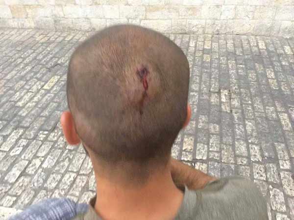 تأهب فلسطيني للتصدي لإقتحام المسجد الأقصى
