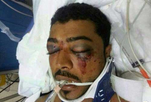 السلطات البحرينية ما زالت تحتجز جثة شهيد