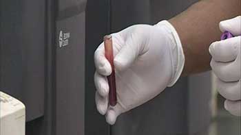 السعودية تعلن تسجيل 10 إصابات جديدة بفيروس كورونا