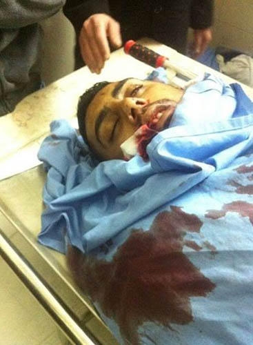 شهيد مقدسي برصاصة في الرأس خلال مواجهات في مخيم قلنديا
