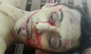 الجمعية البحرينية لحقوق الإنسان تدين قتل الشاب فاضل عباس  