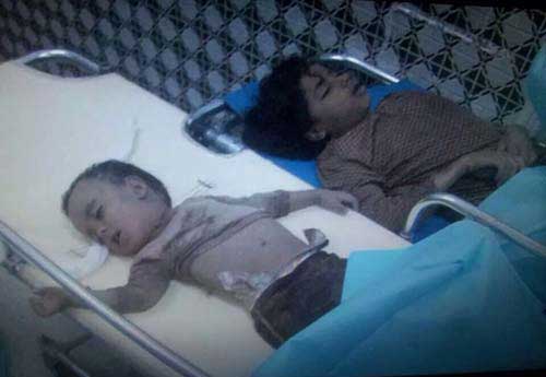 &rsquo;حزم السعودية&rsquo; ضد اطفال اليمن