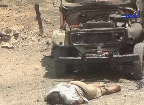 مشاهد وصور مروعة للمجازر السعودية في اليمن - يرجى عدم المشاهدة  لاصحاب القلوب الضعيفة