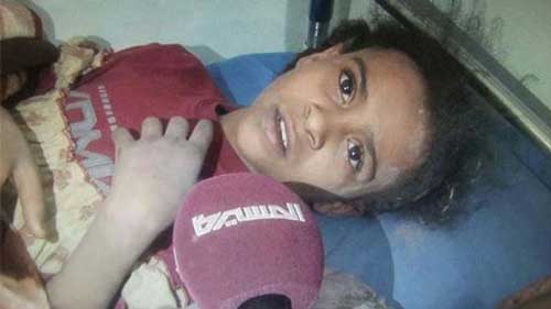 &rsquo;حزم السعودية&rsquo; ضد اطفال اليمن