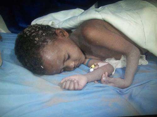 &rsquo;حزم السعودية&rsquo; ضد اطفال اليمن