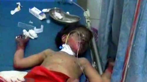 &rsquo;حزم السعودية&rsquo; ضد اطفال اليمن